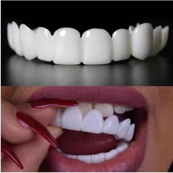 Arrival Upper Plus Lower Flex Whitening Fake Tooth Denture Veneer Braces High Cost Performance 240719