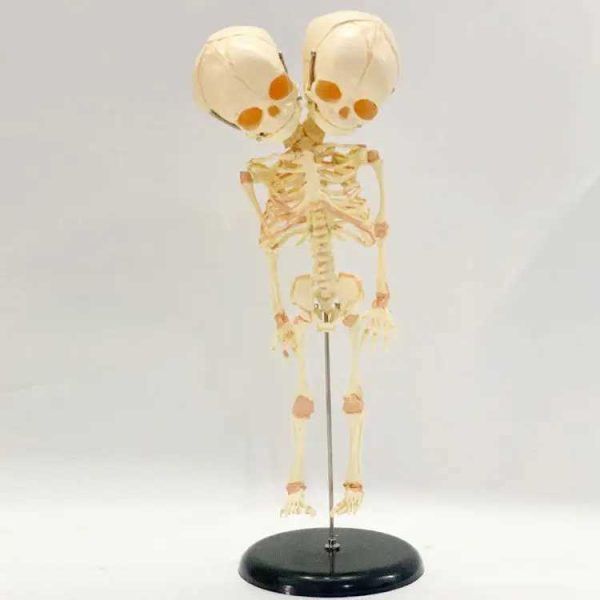 37cm Human Double Head Baby Skull Skeleton Anatomy Brain Display Study Teaching Anatomical Model Halloween Bar Ornament CL240819