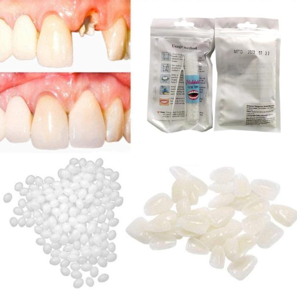 5g/10g/15g/20g Temporary Tooth Repair Kit Teeth And Teeth Whitening Glue False Denture Adhesive Beauty Solid Teeth Gaps Too W7V5